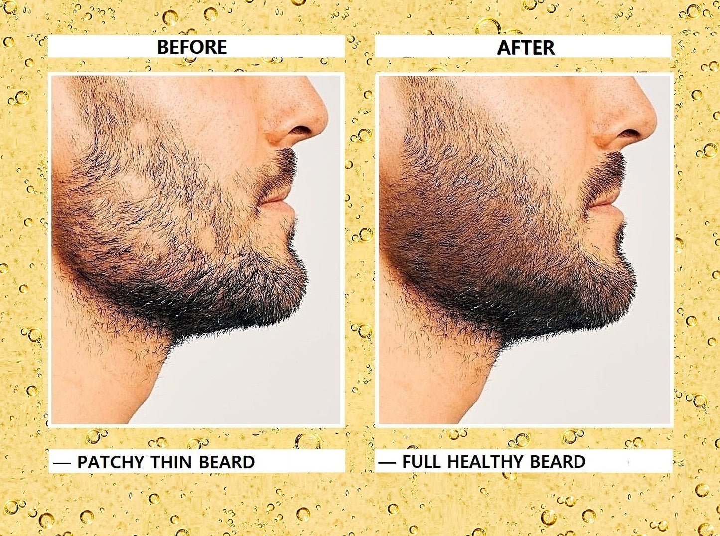 Original Eelhoe Multiuse Hair Growth Oil