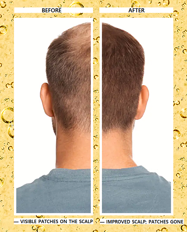 Elaaya Multiuse Hair Growth Oil