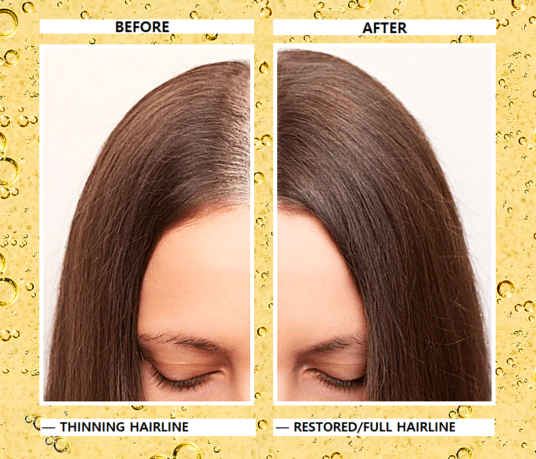Elaaya Multiuse Hair Growth Oil